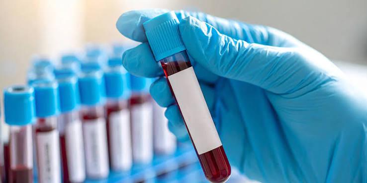 DWI Suspects Have Privacy Rights in Blood Samples