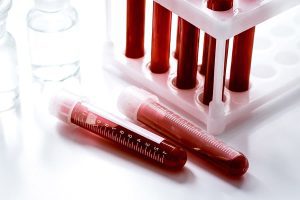 Texas DWI Blood Sample Warrant
