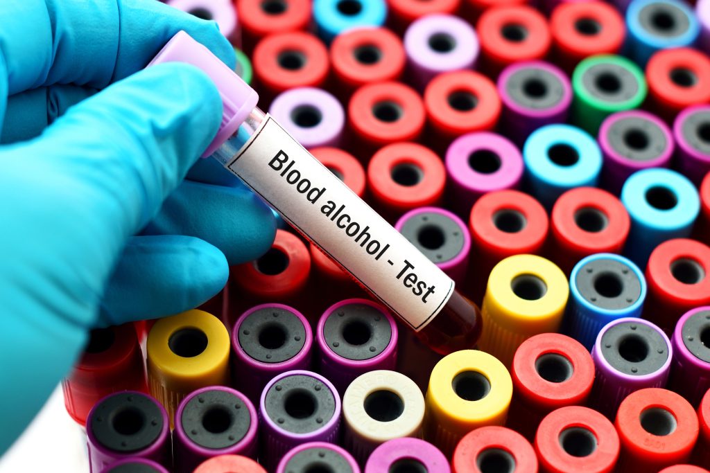 Galveston County DWI lawyer needed to suppress League City DWI blood testing procedure